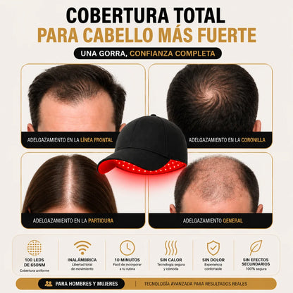 Folux Pro — Gorra LED Capilar 650nm